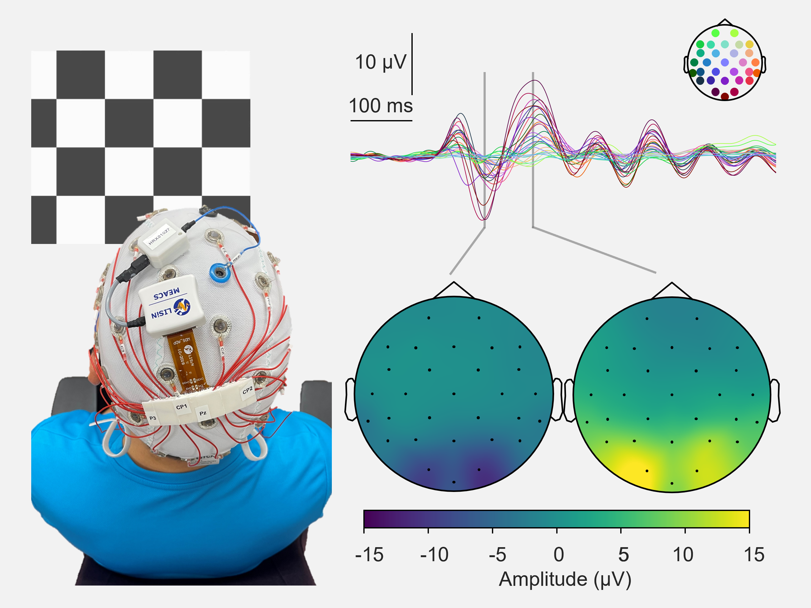 免费午夜爽爽爽www视频十八禁 in dynamic EEG